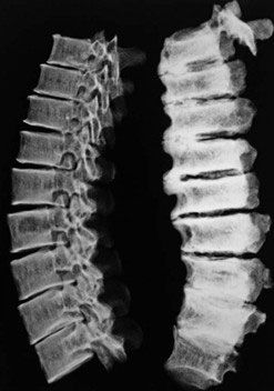 El Juncal, Colombia Treatment Plant